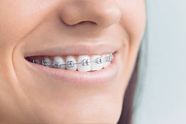 Best Invisalign and Clear Aligners  in New Ulm, MN